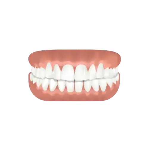 Full Denture